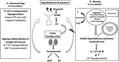 Late-Onset Hypogonadism as Primary Testicular Failure